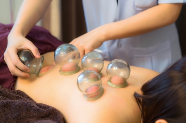 Cupping Therapy Benefits: Ancient Healing for Modern Wellness