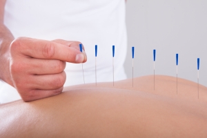 acupuncture denver