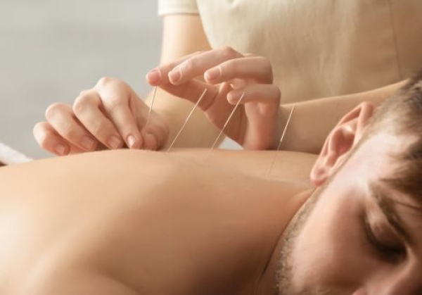 How to Find the Best Acupuncture in Denver