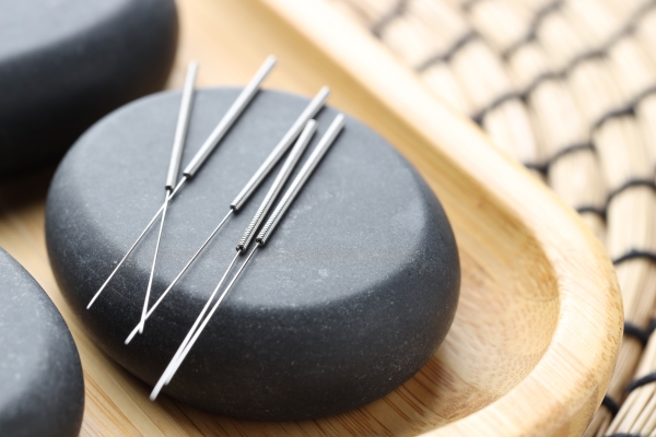 Acupuncture in Denver for Pain, Stress, and Recovery