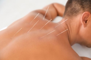 4 Tips To Find The Best Acupuncturist In Denver