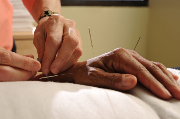 Relieve Pain with Acupuncture in Highlands Ranch