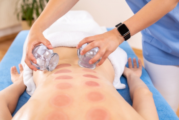 Everything to Know About Cupping Therapy in Denver