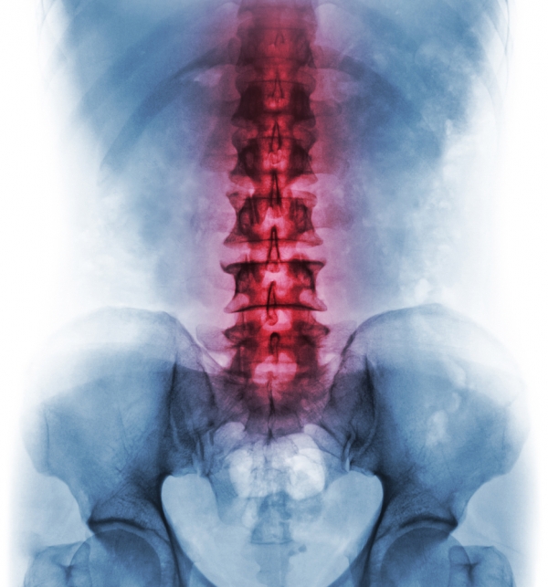 Spinal Adjustment: Can It Help Back Pain?