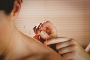 Manage Workplace Stress With Acupuncture In Downtown Denver